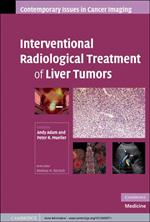 Interventional Radiological Treatment of Liver Tumors