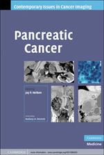 Pancreatic Cancer