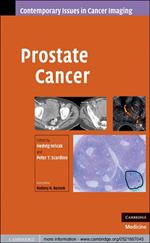 Prostate Cancer