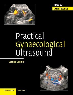 Practical Gynaecological Ultrasound - cover