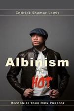 Albinism is Hot!