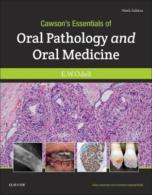 Cawson's Essentials of Oral Pathology and Oral Medicine - Edward W Odell - cover
