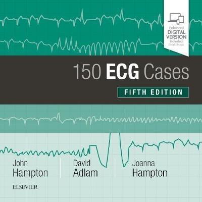 150 ECG Cases - John Hampton,David Adlam,Joanna Hampton - cover