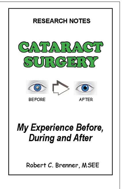 Cataract Surgery: My Experience Before, During and After - Robert C. Brenner - ebook