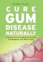 Cure Gum Disease Naturally: Heal Gingivitis and Periodontal Disease with Whole Foods - Ramiel Nagel - cover