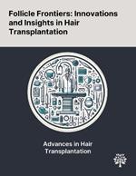 Follicle Frontiers: Innovations and Insights in Hair Transplantation