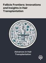 Follicle Frontiers: Innovations and Insights in Hair Transplantation