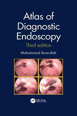 Atlas of Diagnostic Endoscopy, 3E - Mohammad Ibrarullah - cover