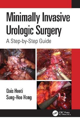 Minimally Invasive Urologic Surgery: A Step-by-Step Guide - Qais Hooti,Sung-Hoo Hong - cover