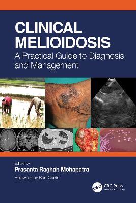 Clinical Melioidosis: A Practical Guide to Diagnosis and Management - cover