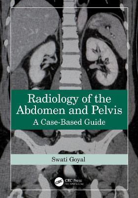 Radiology of the Abdomen and Pelvis: A Case-Based Guide - Swati Goyal - cover