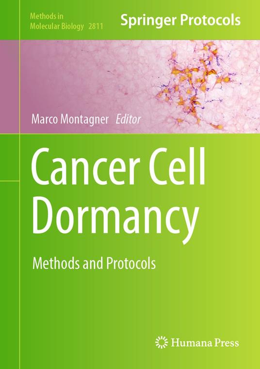 Cancer Cell Dormancy