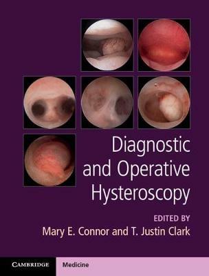 Diagnostic and Operative Hysteroscopy - cover