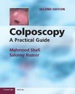 Colposcopy: A Practical Guide