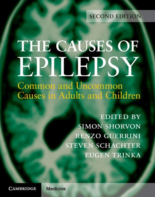 The Causes of Epilepsy