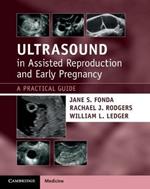 Ultrasound in Assisted Reproduction and Early Pregnancy: A Practical Guide