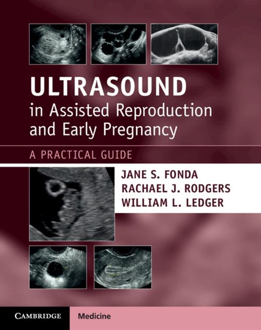 Ultrasound in Assisted Reproduction and Early Pregnancy