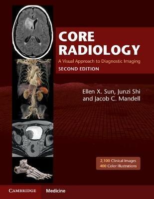 Core Radiology: A Visual Approach to Diagnostic Imaging - cover