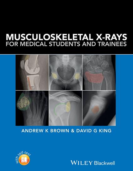 Musculoskeletal X-Rays for Medical Students and Trainees