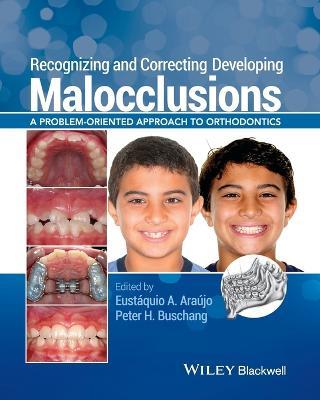 Recognizing and Correcting Developing Malocclusions: A Problem-Oriented Approach to Orthodontics - cover