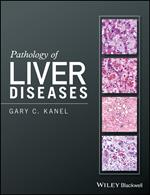 Pathology of Liver Diseases