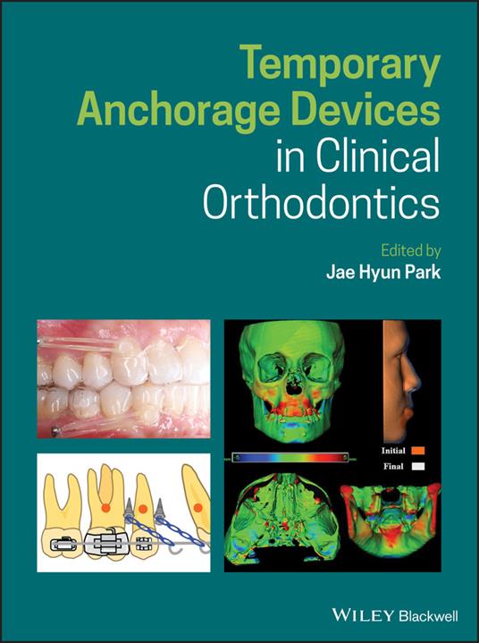 Temporary Anchorage Devices in Clinical Orthodontics - cover