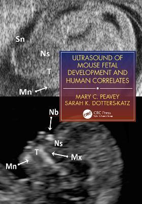 Ultrasound of Mouse Fetal Development and Human Correlates - Mary C. Peavey,Sarah K. Dotters-Katz - cover