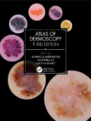 Atlas of Dermoscopy: Third Edition - cover