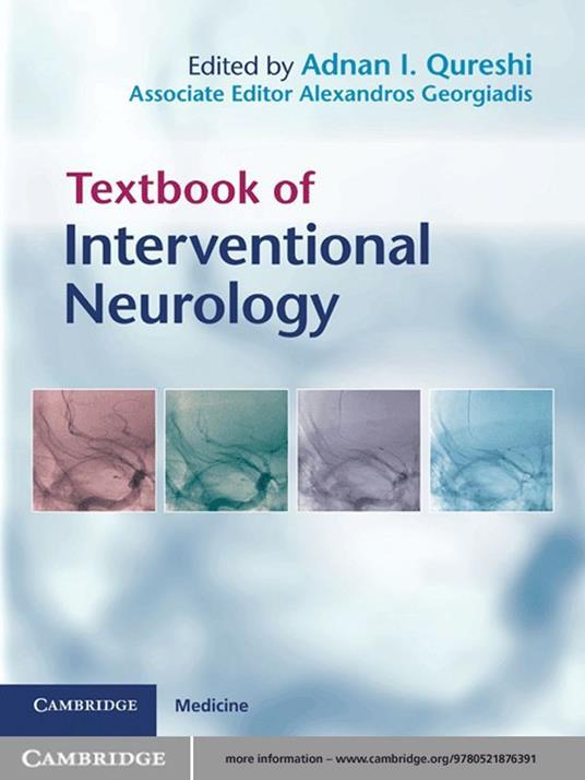 Textbook of Interventional Neurology