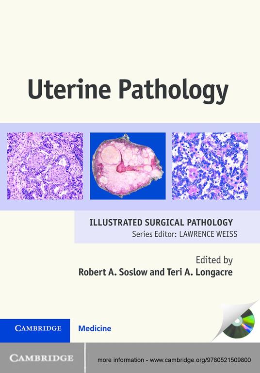 Uterine Pathology