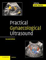 Practical Gynaecological Ultrasound