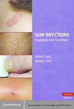 Skin Infections