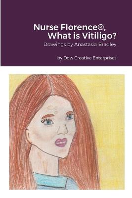 Nurse Florence(R), What is Vitiligo? - Michael Dow - cover