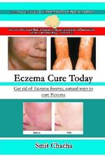 Eczema Cure Today - Get rid of Eczema forever natural ways to cure Eczema