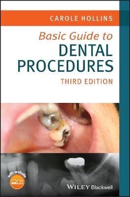 Basic Guide to Dental Procedures - Carole Hollins - cover