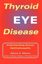 Thyroid Eye Disease: Understanding Graves' Opthalmopathy