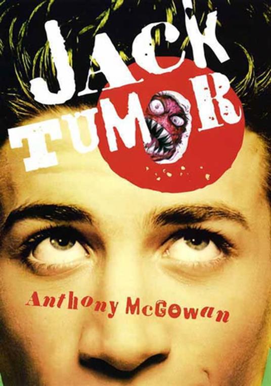 Jack Tumor - Anthony McGowan - ebook