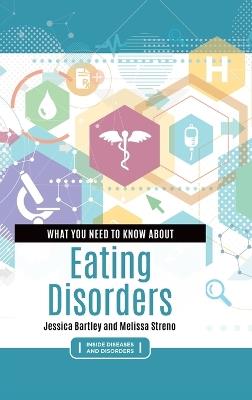 What You Need to Know about Eating Disorders - Jessica Bartley,Melissa Streno - cover