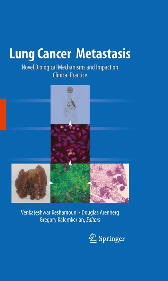 Lung Cancer Metastasis