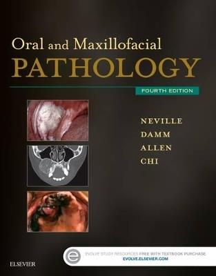 Oral and Maxillofacial Pathology - Brad W. Neville,Douglas D. Damm,Carl M. Allen - cover