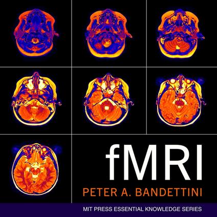 fMRI