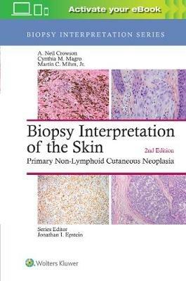 Biopsy Interpretation of the Skin: Primary Non-Lymphoid Cutaneous Neoplasia - A. Neil Crowson,Cynthia M. Magro - cover