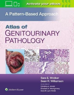 Atlas of Genitourinary Pathology: A Pattern Based Approach - Sara E. Wobker,Sean R. Williamson - cover