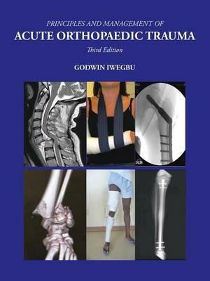 Principles and Management of Acute Orthopaedic Trauma: Third Edition - Godwin Iwegbu - cover