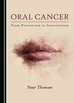 Oral Cancer: From Prevention to Intervention