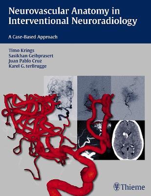 Neurovascular Anatomy in Interventional Neuroradiology: A Case-Based Approach - Timo Krings,Sasikhan Geibprasert,Juan Pablo Cruz - cover