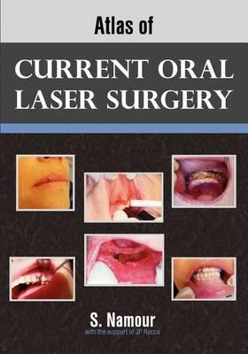 Atlas of Current Oral Laser Surgery - S Namour - cover