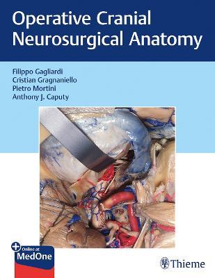 Operative Cranial Neurosurgical Anatomy - Filippo Gagliardi,Cristian Gragnaniello,Pietro Mortini - cover