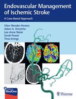 Endovascular Management of Ischemic Stroke