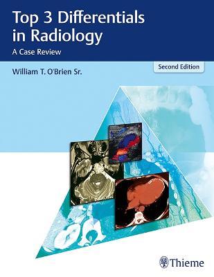 Top 3 Differentials in Radiology: A Case Review - William T. O'Brien - cover